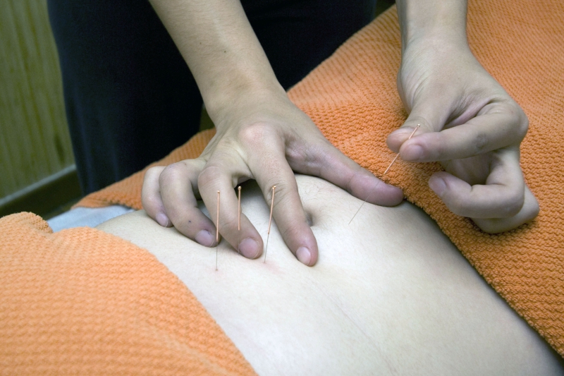 osteopathe-TOURRETTES SUR LOUP-min_acupuncture-4175625